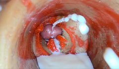 Camera Inside Deep Pussy toy Captures dose Ejaculation of Sperm
